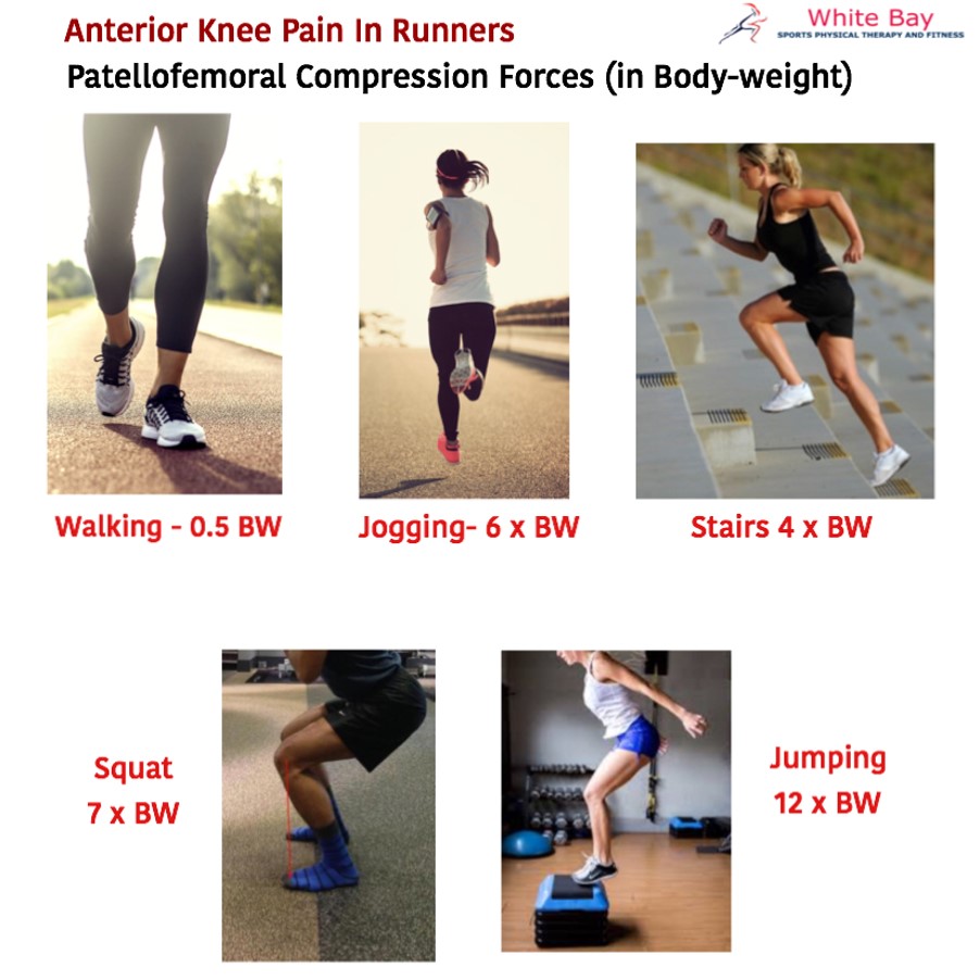 Anterior Knee Pain in runners