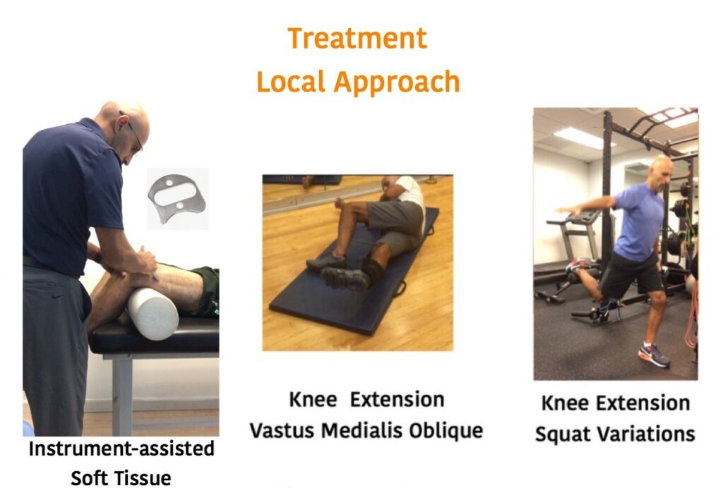 Patellofemoral Pain Syndrome Local Approach