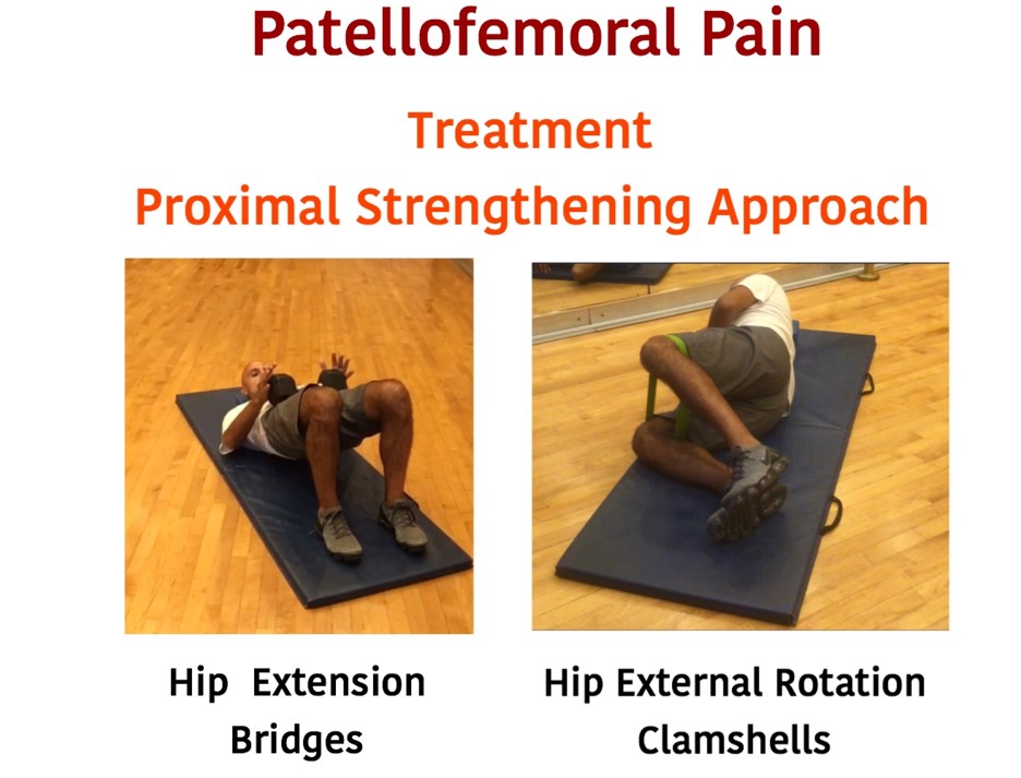 Patellofemoral Pain Syndrome Treatment